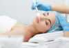 Peeling chemiczny dostępny w salonie od.NOVA Poznań Peeling chemiczny